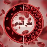 صورة توضيحة تظهر الفرق بين كريات الدم في الحالة الطبيعية وفي حالة الانيميا